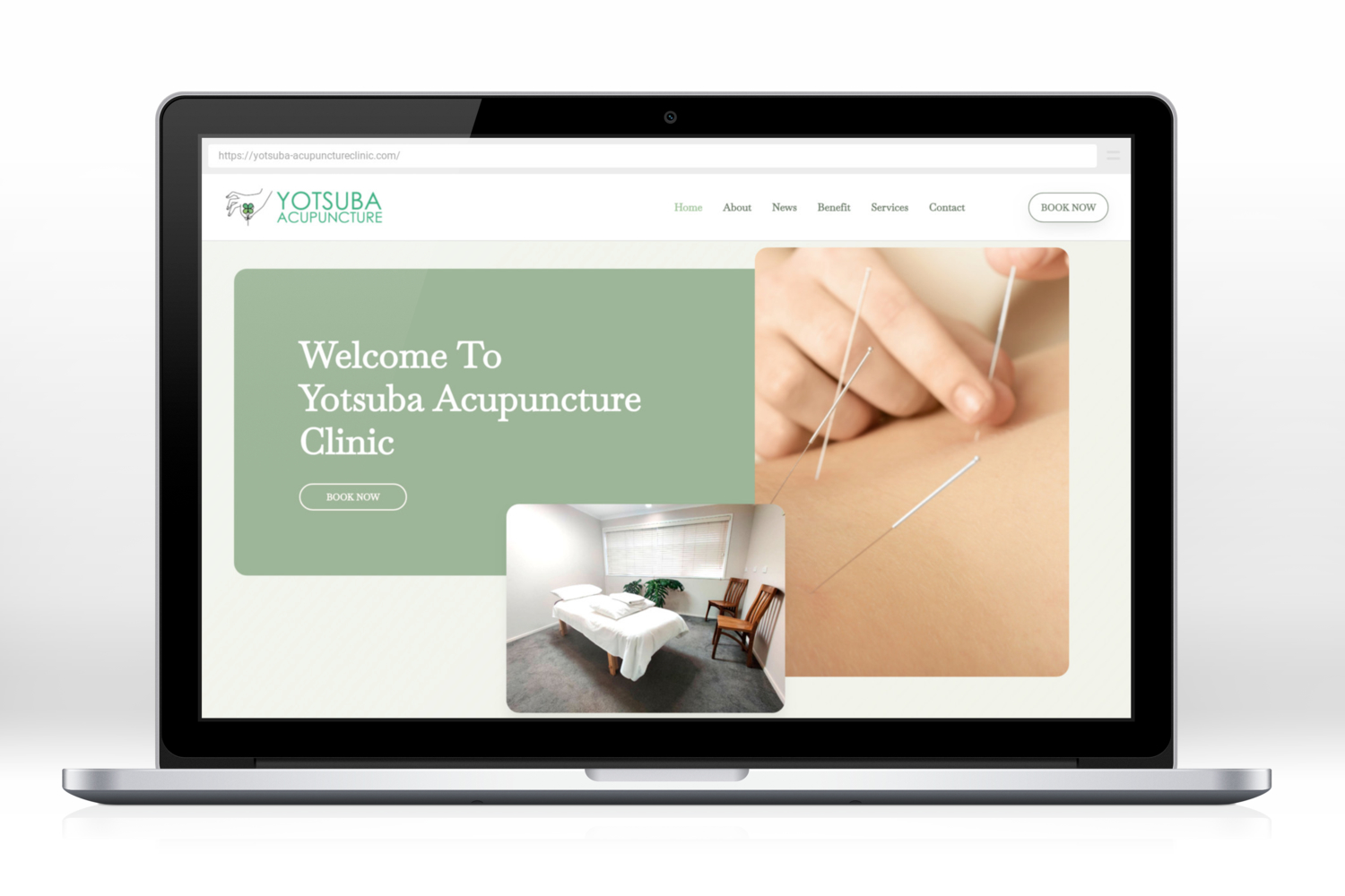 yotsuba acupuncture clinic